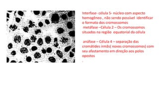 Interfase- célula 5- núcleo com aspecto
homogêneo , não sendo possível identificar
o formato dos cromossomos
metáfase –Célula 2 – Os cromossomos
situados na região equatorial da célula
anáfase – Célula 4 – separação das
cromátides irmãs( novos cromossomos) com
seu afastamento em direção aos polos
opostos
.
 