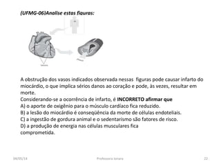 (UFMG-06)Analise estas figuras:
A obstrução dos vasos indicados observada nessas figuras pode causar infarto do
miocárdio, o que implica sérios danos ao coração e pode, às vezes, resultar em
morte.
Considerando-se a ocorrência de infarto, é INCORRETO afirmar que
A) o aporte de oxigênio para o músculo cardíaco fica reduzido.
B) a lesão do miocárdio é conseqüência da morte de células endoteliais.
C) a ingestão de gordura animal e o sedentarismo são fatores de risco.
D) a produção de energia nas células musculares fica
comprometida.
04/05/14 22Professora Ionara
 
