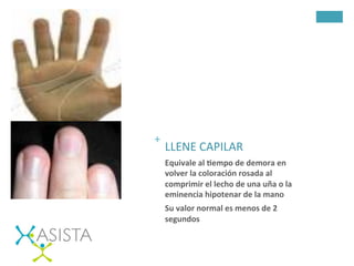 +	
  	
  
LLENE	
  CAPILAR	
  
Equivale	
  al	
  Fempo	
  de	
  demora	
  en	
  
volver	
  la	
  coloración	
  rosada	
  al	
  
comprimir	
  el	
  lecho	
  de	
  una	
  uña	
  o	
  la	
  
eminencia	
  hipotenar	
  de	
  la	
  mano	
  
Su	
  valor	
  normal	
  es	
  menos	
  de	
  2	
  
segundos	
  
	
  
	
  
 