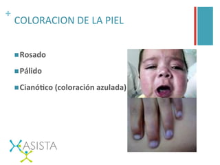 +	
  
COLORACION	
  DE	
  LA	
  PIEL	
  
n Rosado	
  
n Pálido	
  
n CianóFco	
  (coloración	
  azulada)	
  
 