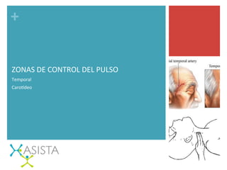 +	
  
ZONAS	
  DE	
  CONTROL	
  DEL	
  PULSO	
  
Temporal	
  
CaroGdeo	
  
 