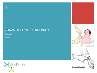+	
  
ZONAS	
  DE	
  CONTROL	
  DEL	
  PULSO	
  
Braquial	
  
Radial	
  
 