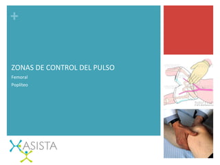 +	
  
ZONAS	
  DE	
  CONTROL	
  DEL	
  PULSO	
  
Femoral	
  
Poplíteo	
  
 