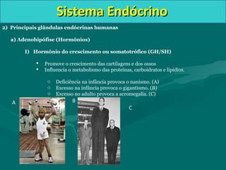 Sistema EndócrinoSistema Endócrino
2) Principais glândulas endócrinas humanas
a) Adenohipófise (Hormônios)
I) Hormônio do crescimento ou somatotrófico (GH/SH)
 Promove o crescimento das cartilagens e dos ossos
 Influencia o metabolismo das proteínas, carboidratos e lipídios.
o Deficiência na infância provoca o nanismo. (A)
o Excesso na infância provoca o gigantismo. (B)
o Excesso no adulto provoca a acromegalia. (C)
A B
C
 