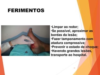 FERIMENTOS
17
•Limpar ao redor;
•Se possível, aproximar as
bordas da lesão;
•Fazer tamponamento com
atadura compressiva;
•Prevenir o estado de choque;
•Havendo grandes lesões,
transporte ao hospital.
 