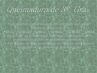 Queimadura de 3º Grau
  • Queimadura esbranquiçada, tão profunda que atinge
                    os músculos e ossos.
• Os tecidos ficam negros e sem vida,("NECROSE") não há
   dor porque as terminações nervosas responsáveis pela
        sensibilidade à dor foram também queimadas.
 • Nas bordas de uma queimadura de terceiro grau haverá
          queimaduras de primeiro e segundo grau.
 