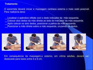 Tratamento
O socorrista deverá iniciar a massagem cardíaca externa o mais cedo possível.
Para realizá-la deve:
__Localizar o apêndice xifóide com o dedo indicador da mão esquerda.
__Colocar dois dedos da mão direita ao lado do indicador da mão esquerda.
__Após colocar os dois dedos, posicionar a palma da mão esquerda.
__Posicionar a mão direita sobre a mão esquerda, cruzando os dedos.
Em consequência da massagem,o esterno, em vítima adultas, deverá ser
deslocado para baixo entre 5 e 6 cm.
 