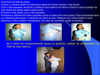 Posicionar-se atrás da vítima.
Colocar o cotovelo direito na crista ilíaca direita da vítima e fechar a mão direita.
Com a mão esquerda, encontrar a ponta do osso esterno da vítima e colocar a raiz do polegar da
mão direita dois dedos abaixo desse ponto.
Envolver a mão direita com a mão esquerda.
Pressionar o abdome da vítima puxando-o para si e para cima cinco vezes. Essa compressão deve
ser suficiente para erguer o calcanhar da vítima do solo. Observar se a vítima expele o corpo
estranho e volta a respirar normalmente. Em caso de insucesso, repetir a manobra.
Se a vítima for excessivamente obesa ou gestante, realizar as compressões no
meio do osso esterno.
 