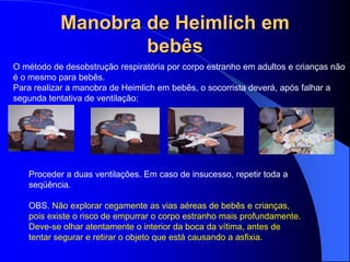 Manobra de Heimlich em
bebês
O método de desobstrução respiratória por corpo estranho em adultos e crianças não
é o mesmo para bebês.
Para realizar a manobra de Heimlich em bebês, o socorrista deverá, após falhar a
segunda tentativa de ventilação:
Proceder a duas ventilações. Em caso de insucesso, repetir toda a
seqüência.
OBS. Não explorar cegamente as vias aéreas de bebês e crianças,
pois existe o risco de empurrar o corpo estranho mais profundamente.
Deve-se olhar atentamente o interior da boca da vítima, antes de
tentar segurar e retirar o objeto que está causando a asfixia.
 