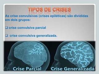 As crise convulsivas (crises epiléticas) são divididas
em dois grupos:
 crise convulsiva parcial
 crise convulsiva generalizada.
 