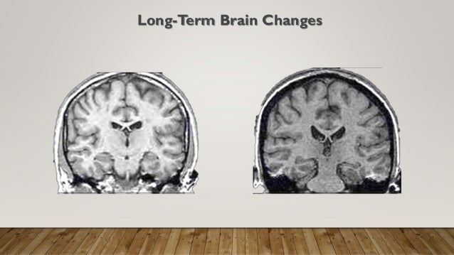 How Trauma Is Changing Childrens Brains >> Trauma Informed Game Based Learning For Kids How Trauma Is Changing Childrens Brains >> Trauma Informed Game Based Learning For Kids