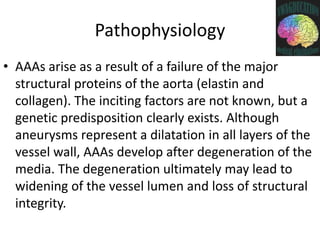 Abdominal Aortic Aneurysms | PPTX