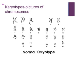 +
Karyotypes-pictures of
chromosomes
 