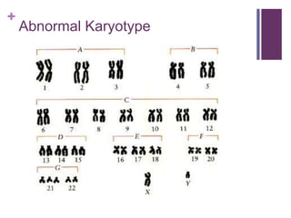 +
Abnormal Karyotype
 