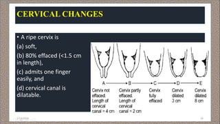 Cervical Ripe Introduction to Normal Labour | PPTX