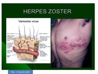 11
Pan . C Cys.G U,DU
 