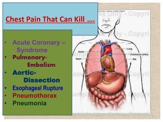 Chest Pain That Can Kill ….
• Acute Coronary –
Syndrome
• Pulmonary-
Embolism
• Aortic-
Dissection
• Esophageal Rupture
• Pneumothorax
• Pneumonia
5
 