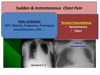 Sudden & Instantaneous Chest Pain
Tension Pneumthorax
• Spontaneous
• Open
Pulm. Embolism
DVT, Obesity, Pregnancy, Prolonged
immobilization, CHF ….
6
 