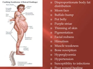  Disproportionate body fat
distribution
 Moon face
 Buffalo hump
 Pot belly
 Purple striae
 Thinning of skin
 Pigmentation
 Facial redness
 Hirsutism
 Muscle weakness
 Bone resorption
 Hyperglycemia
 Hypertension
 Susceptiblity to infections
 Poor wound healing
 