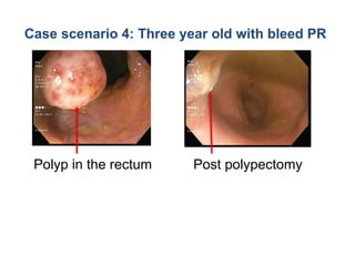 1st May.pptx gastroenterologist clinic knowledge | PPTX