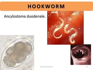 HOOKWORM
Ancylostoma duodenale.
04-Apr-17 10:38 AM 20USTAZ ELHADI 2017
 