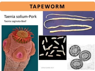 TAPEWORM
Taenia solium-Pork
Taenia saginata-Beef
04-Apr-17 10:38 AM 22USTAZ ELHADI 2017
 