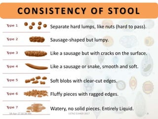 Separate hard lumps, like nuts (hard to pass).
Sausage-shaped but lumpy.
Like a sausage but with cracks on the surface.
Like a sausage or snake, smooth and soft.
Soft blobs with clear-cut edges.
Fluffy pieces with ragged edges.
Watery, no solid pieces. Entirely Liquid.
CONSISTENCY OF STOOL
04-Apr-17 10:38 AM 8USTAZ ELHADI 2017
 