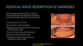 Development, anatomy and growth of mandible | PPTX
