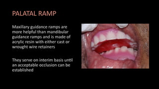 Maxillary Ramps Development, anatomy and growth of mandible | PPTX