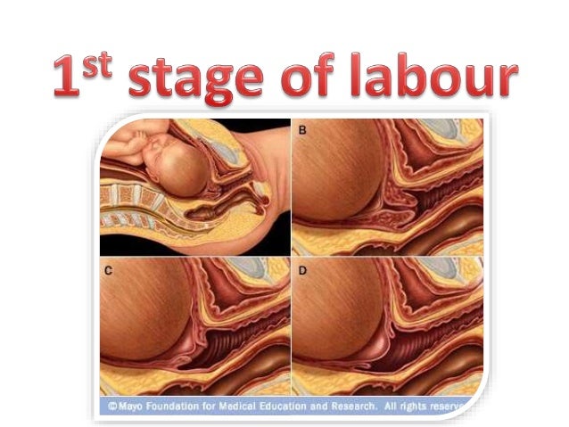 dilatation vaginale extreme dilatation vaginale extreme