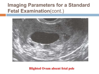 Blighted Ovum absent fetal pole
Imaging Parameters for a Standard
Fetal Examination(cont.)
 