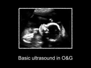 Basic ultrasound in O&G

 