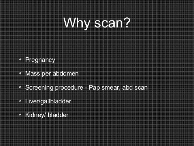 Dating scan 3 weeks out
