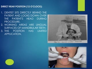 DIRECT REAR POSITION (12 O'CLOCK):
1. DENTIST SITS DIRECTLY BEHIND THE
PATIENT AND LOOKS DOWN OVER
THE PATIENT'S HEAD DURING
PROCEDURE.
2. WORKING AREAS ARE LINGUAL
SURFACES OF MANDIBULAR TEETH.
3. THIS POSITION HAS LIMITED
APPLICATION.
 