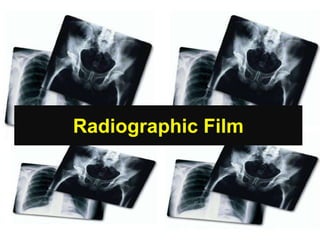 Radiographic Film
 