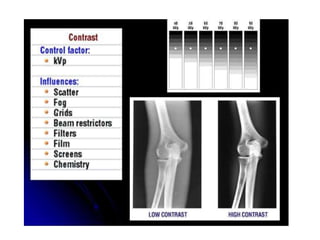 Inverted Radiographic Film radiographic film | PPTX