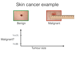 Malignant?
Tumour size
Benign Malignant
Skin cancer example
Yes(1)
No(0)
 