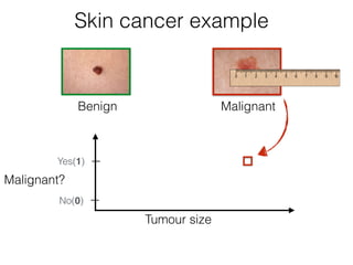 Malignant?
Tumour size
Benign Malignant
Skin cancer example
Yes(1)
No(0)
 