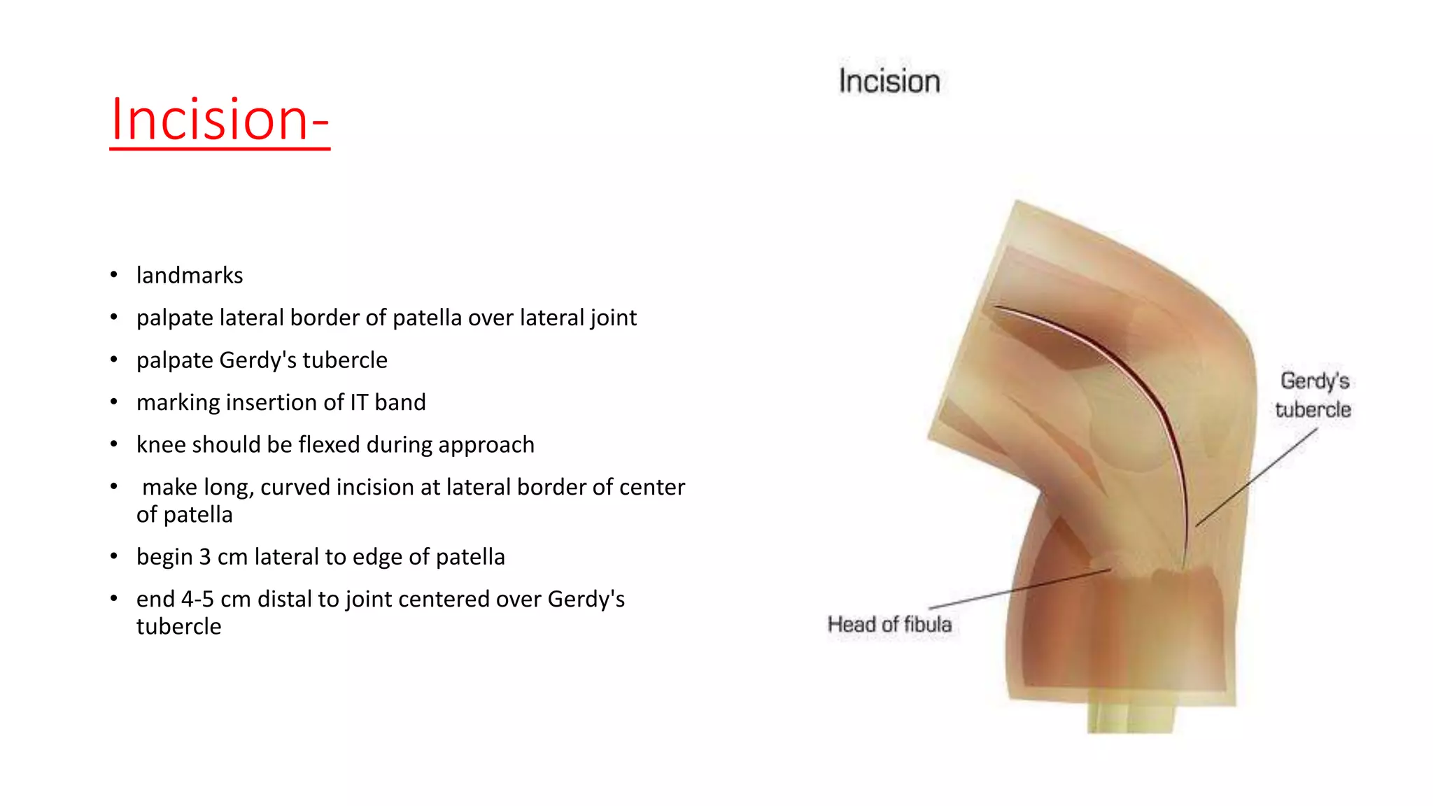 surgerical approach knee | PPT