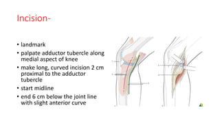 surgerical approach knee | PPTX