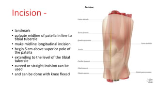 surgerical approach knee | PPTX