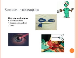 1 surgical techniques and topical haemostatic agents in patient | PDF