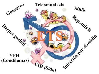 Tricomoniasis




   VPH
(Condilomas)
 
