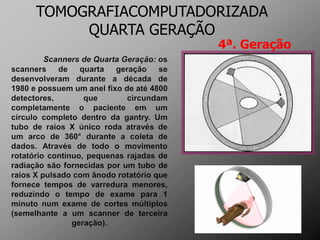 TOMOGRAFIACOMPUTADORIZADA
     QUARTA GERAÇÃO
                   4ª. Geração
 