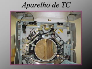 Aparelho de TC
 