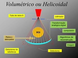 Volumétrico ou Helicoidal
    Tubo de raios-X
                                 colimador


                             Transformação
                             analógico-digital

                                             computador
                      ROI

 Raios-x                                 Algoritmos de
atenuados                                reconstrução

                                                 Imagem

Detectores de
                            Detectores
 referência
 
