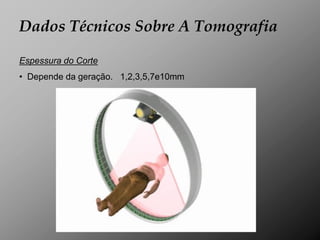 Dados Técnicos Sobre A Tomografia

Espessura do Corte
• Depende da geração. 1,2,3,5,7e10mm
 