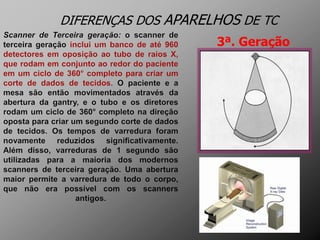 DIFERENÇAS DOS APARELHOS DE TC
                     3ª. Geração
 