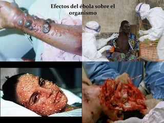 Efectos del ébola sobre el
organismo
 
