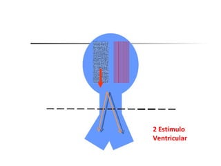 2 Estímulo  Ventricular 